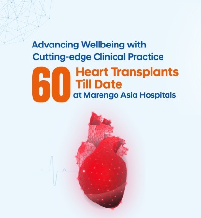 60 Heart Transplant