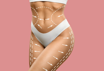 Common Misconceptions about Liposuction