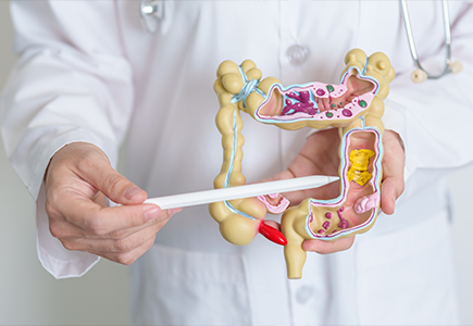 8 Tips to Prevent Gastrointestinal Cancers