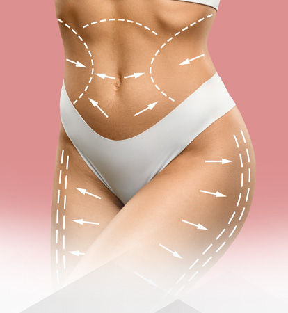 Common Misconceptions about Liposuction