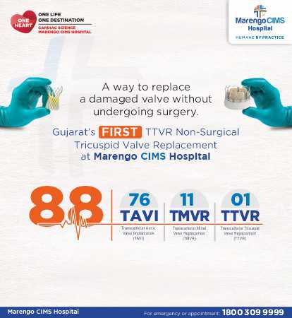 TTVR Non Surgical