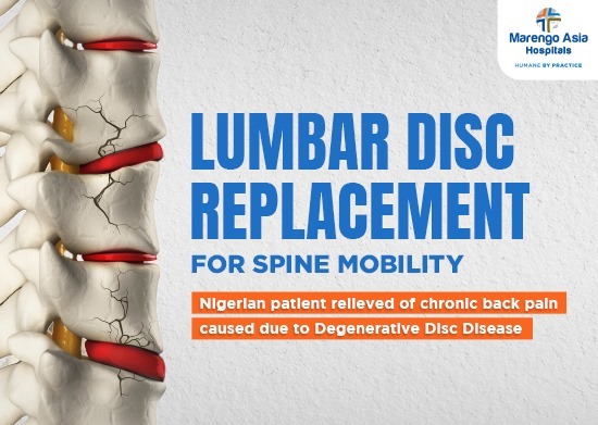 Gurgaon’s First Baguera Lumbar Disc Replacement on a 28-Year-Old Nigerian Patient