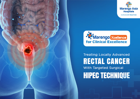 Successful Abdominoperineal Resection with HIPEC for Locally Advanced Rectal Cancer